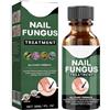 KOAHDE Funghi Unghie Trattamento,Rinforza la Struttura Dell'Unghia,Soluzione per La Riparazione delle Unghie del Piede,Liquido per Infezione delle Unghie,30ML