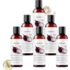 SKZKK Shampoo a cipolla con olio di cipolla e rosmarino per la crescita dei capelli e la cura dei capelli sottili. Idrata, pulisce e promuove capelli più forti e densi in donne e uomini. (6 pezzi)