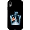 Rib Cage X-Ray Pizza Anatomy Co. Custodia per iPhone XR Fetta di pizza a raggi X con gabbia costale divertente cibo umorismo anatomia