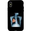 Rib Cage X-Ray Pizza Anatomy Co. Custodia per iPhone X/XS Fetta di pizza a raggi X con gabbia costale divertente cibo umorismo anatomia