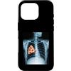 Rib Cage X-Ray Pizza Anatomy Co. Custodia per iPhone 16 Pro Fetta di pizza a raggi X con gabbia costale divertente cibo umorismo anatomia