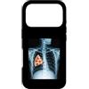 Rib Cage X-Ray Pizza Anatomy Co. Custodia per iPhone 17 Pro Fetta di pizza a raggi X con gabbia costale divertente cibo umorismo anatomia