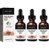 BAInuai Melanina Correcting Facial Serum, Sotck Solution, Melanina Face Repair Essence, Dark Spot Corrector Remover, Anti-ossidazione Facial Serum, Moisturize Skin, White And Fade Melanina (3 pezzi)