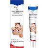 Uzionoie Fibromi Penduli Rimozione,Verruche Rimozione,Crema Occhio di Pernice,Rimuovitore Di Fibromi Penduli Per Il Viso,Delicata Naturale Ad Azione Rapida