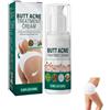 Uzionoie Culo Acne Crema,Crema Per Rimuovere l'acne Sui Glutei,Riduzione Brufolo Culo,Ripristina La Pelle Del Sedere Morbida E Liscia,100ML