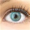 GLAMLENS Lenti a contatto colorate blu Venedig Blue - mensili - con porta lenti a contatto - blu naturali in silicone idrogel - 2 pezzi - DIA 14.00 - senza correzione 0.00 diottrie