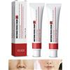 HADAVAKA Acne Scar Removal Removal Cream, Pigmentation Removal Cream For Face, Anti-wrinkle Moisturizing Anti-blemish Effective Remove Melasma (2 Blemish Cream)