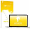 upscreen Pellicola Protettiva per Displays 24 (61 cm) [532x299 mm, 16:9] | Opaca Protezione Schermo Made in Germany Schermo piatto Anti-Riflesso Anti-Impronte Mounting Kit