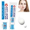 QEEROYO Crema Schiarente Per L'acne, Crema per Il Trattamento 'acne, Lozione Idratante Viso Anti Acne, Adatta a Tutti i Tipi di Pelle, per l'Acne, 25g