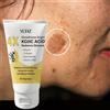 YCHZ La crema viso all'acido kojico uniforma il tono della pelle, elimina le macchie scure e l'effetto opaco - Non grassa, adatta sia per uomini che per donne - Crema sbiancante e idratante, per l'uso di
