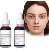 Pemarlis 2PCS Siero schiarente per rimuovere le macchie scure, olio siero correttivo per viso e corpo olio naturale sbiancante e schiarente per il trattamento della pelle con segni di acne e brufoli