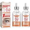 Wootapson 2Pc Speedy Milia Remover, Trattamento Per Macchie Milia Per Gli Occhi, Facial Serum, Minimizza Le Imperfezioni Del Viso, Leviga La Grana Della Pelle, Illumina L'incarnato