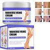 Nexolla Crema Vene Varicose, Crema Contro le Vene Varicose, Crema per Vene Varicose, Crema Per La Cura Delle Gambe, Crema per la Riparazione Delle Gambe di Ragno Riduce Il Dolore E La Stanchezza Delle Gambe