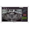 AG Neovo DR-2202 Monitor 21.5IN FHD 1920 X 1080 1000:1 500 CD/M2 5MS VGA/USB