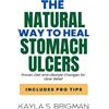 Kayla S Brigman The Natural Way to Heal Stomach Ulcers (Tascabile)