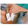 LOHMANN & RAUSCHER Srl Medicazione per tubi di drenaggio fessurata metalline drain 6x7cm foro 4,5x11mm 50 pezzi