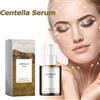 eelhoe Centella Siero Nutriente Miglioramento Pelle Secca Levigante Ringiovanimento Illumina Idratante Acido Ialuronico Viso Essenza Cura Della Pelle