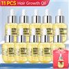 PURC 10PCS crescita dei capelli per uomo donna prodotti olio per capelli allo zenzero siero a crescita rapida trattamento del cuoio capelluto ricrescita Anti-perdita cura dei capelli