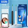NATFIRE Detergente per cerume wireless con fotocamera Endoscopio sicuro per la rimozione del cerume con fotocamera Otoscopio luminoso Strumenti per la pulizia dell'orecchio Cura dell'orecchio