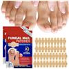 Cutiolly Fungal Nail Patches,42pcs Funghi Unghie Piedi,Cerotti per Unghie Incarnite Piedi,Micosi Unghie Piede Patches,Trattamento Antifungino per Unghie,Cerotti per Trattamento Unghie Dei Funghi