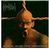 Sexual affective disorder (1994)