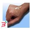 SMITH & NEPHEW SRL FOGLIO AUTO ADERENTE IN GEL DI SILICONE CICA CARE PER IL TRATTAMENTO DELLE CICATRICI 12CMX15CM 1MED