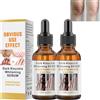 Utapossin Essenza di sbiancamento delle mani, siero sbiancante della pelle, siero schiarente la pelle scura, riproduce l'iperpigmentazione Age, rimozione delle dita delle caviglie scure, per i gomiti, 30 ml x 2