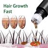 NONE Biotina fast Hair Growth oil Products Care trattamenti per il massaggio del cuoio capelluto Anti perdita di capelli efficace Grow siero per capelli più spesso per gli uomini
