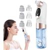 Generic Black Head Remover - Aspirapolvere elettrico per la pulizia dei pori del viso, ricaricabile, regolabile, con 6 ventose, per donne e uomini