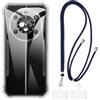 Shantime Custodia e lanyard per Fossibot F109 - Chiaro+Nero | 6.74 Set composto da custodia protettiva e tracolla staccabile con fibbie metalliche e 2 patch