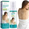 BAInuai Back Acne Spray, Back Acne Treatment Spray, Acne Spray per Back and Body, Tea Tree Oil Back Acne Solution, Body Back Acne Solution, 120 ml
