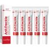 SADOER Crema Anti Lentiggine Creme Schiarente Viso Rimozione Macchie Anti-età Idratante Lentiggine Rimozione Crema Per Il Viso Cura Della Pelle