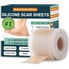 Eiiioea silicone scar sheets Backing, does not contain scar sheets