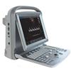 Chison Eco-5 vet Gima - Ecografo