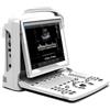 Chison Eco3 Gima - Ecografo