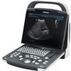 Mindray DP-20 Gima - Ecografo