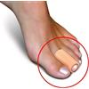 Tubolare in gel e tessuto WellOrtho - Tutore Ortopedico