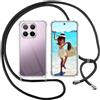 ISOI Cover con Cordino per Xiaomi 17T, Custodia Trasparente con Collana Tracolla Laccio Collo Ultra Sottile Morbido TPU Silicone Antiurto AntiGraffio Case, Nero