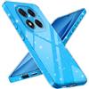 Paitech Cover per Xiaomi Redmi Note 14 Pro 5G/ Redmi Note 14 Pro Plus 5G Custodia in Silicone, Protezione Completa della Fotocamera, Custodia Protettiva Sottile in TPU Morbido con Finitura Glitter Blu