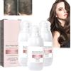 Giurui Zephta H-Regrow 2.0 - Zephta Hair Regrowth, ProRevita Rice Nutri Spray, Hair Helper Spray, Hair Care Sprays for Thinning Hair & Hair Loss, For All H-air Types (3 Pcs)