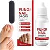 Generic Ammorbidente professionale per unghie incarnite, 15 ml, rinforza il gel per unghie, per piede giallo, cuticole, dita dei piedi, pedicure, donne, uomini