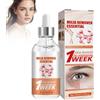 Grgowe Speedy Milia Remover, Trattamento Per Macchie Milia Per Gli Occhi, Facial Serum, Leviga e Uniforma la Grana Della Pelle, Riduce le Occhiaie e Illumina l'incarnato