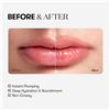 VT COSMETICS Reedle Shot Lip Plumper Beginner 5 g Make up