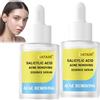 IATAHI Siero Anti Acne per Viso,2pcs Brufoli Viso Cura, Facial Essence,Con Contagocce di Precisione,Visos Essenza,Adatto a Tutti i Tipi di Pelle,Aiuta a Ridurre le Impurità,30ml
