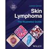 Wiley Skin Lymphoma: The Illustrated Guide