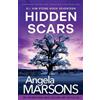 Angela Marsons Hidden Scars (Tascabile) Detective Kim Stone