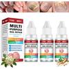 NoraGlaze 3 unghie fungine per unghie dei piedi, extra forti, funghi per unghie dei piedi, cura delle unghie per un aspetto fragile, spesso, ruvido, formula idratante, 30 ml