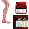 Boxiatil Varicose Veins Cream, balsamo per la cura delle gambe - Crema contro le vene varicose e le vene varicose, cura naturale delle gambe, migliora la circolazione sanguigna, nutre e lenisce le