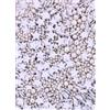 Graziano Sprinkles per dolci Silver 50g