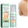 Nexolla Spray per Brufoli Corpo, Trattamento Dell'Acne Su Schiena, Spray Per La Rimozione Dei Brufoli Sulla Schiena, Petto e Schiena, Torna Soluzione Brufolo, Trattamento dell'acne su Schiena e Spalle